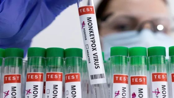 New Guidelines for Confirmed Monkeypox Cases Includes 21 Days of Self-Quarantine